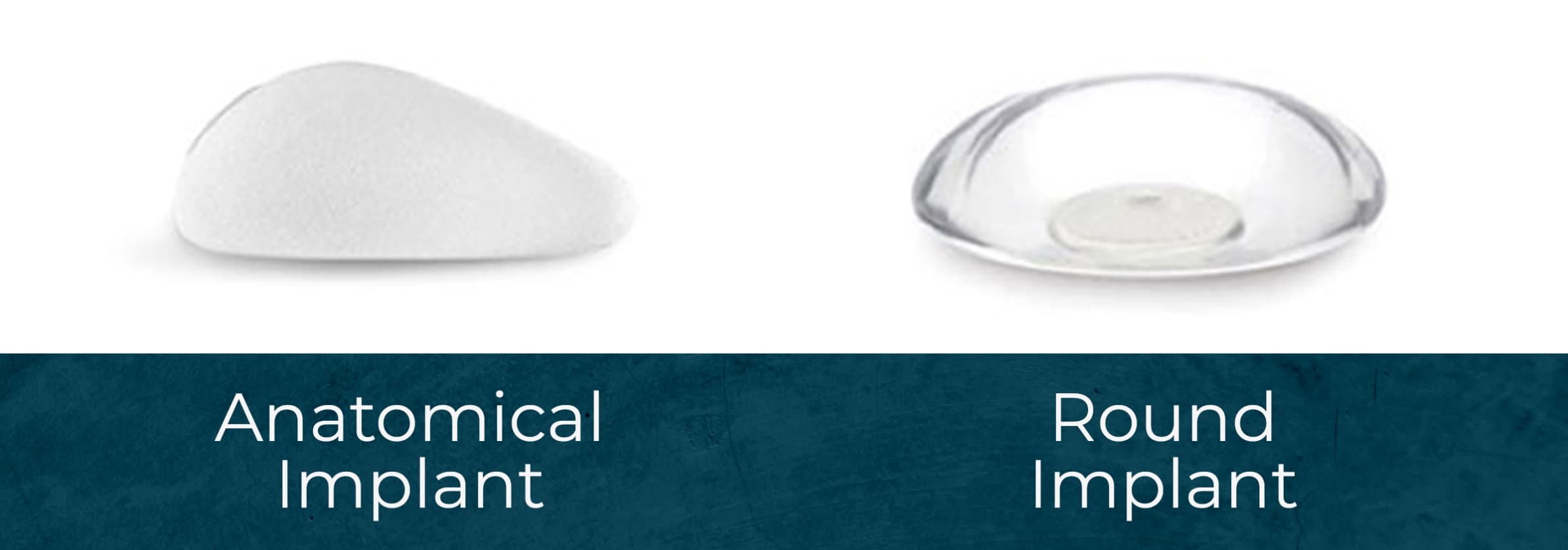 Anatomical implant and round implant