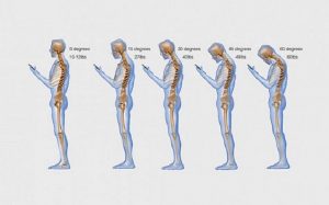 smartphone-posture-tech-neck (1)