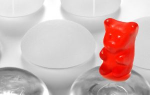 Gummy bear implants
