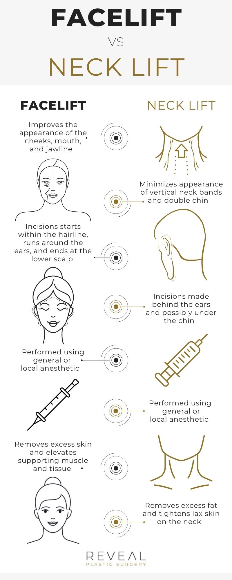  Infographic showcasing the different areas of the face addressed with facelift and neck lift procedures.